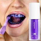 SmileKit V34 spalvos korektorius (violetinė dantų pasta) – 30 ml